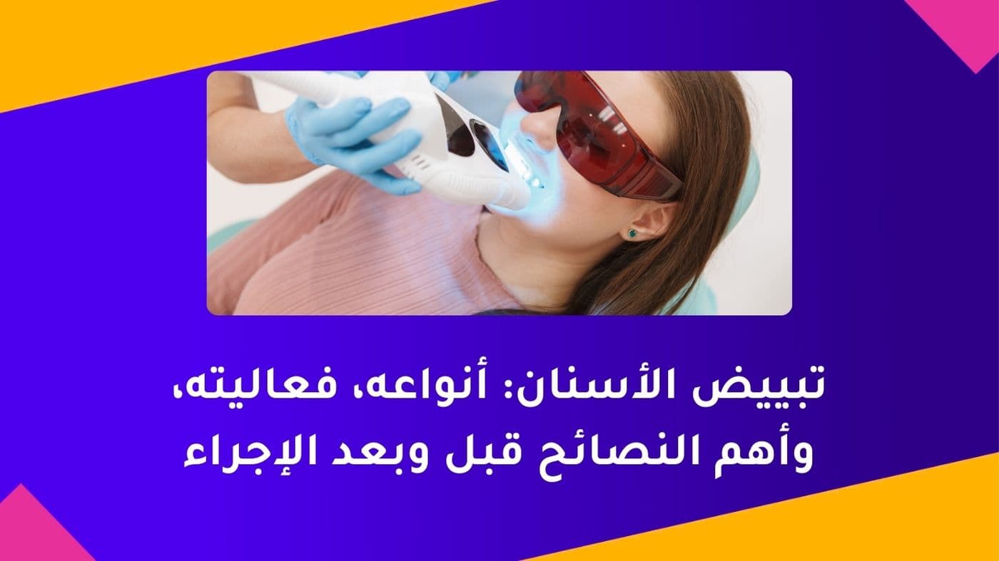تبييض الأسنان: أنواعه، فعاليته، وأهم النصائح قبل وبعد الإجراء