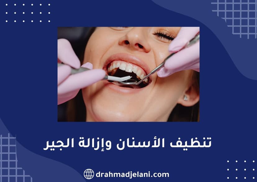 تنظيف الأسنان وإزالة الجير