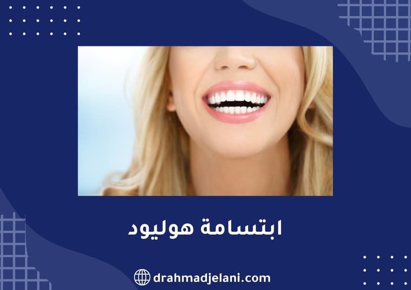 ابتسامة هوليود