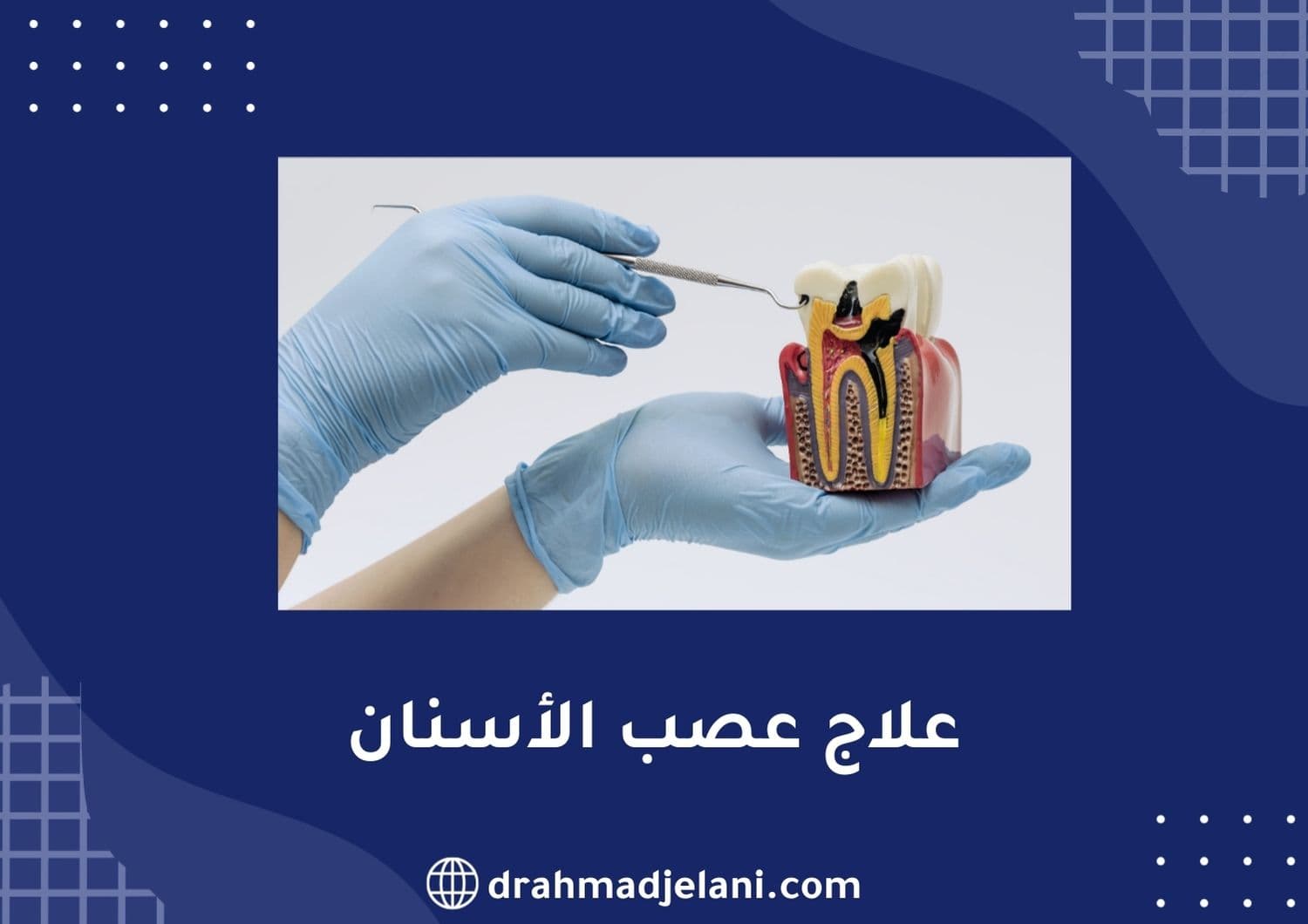 علاج عصب الأسنان