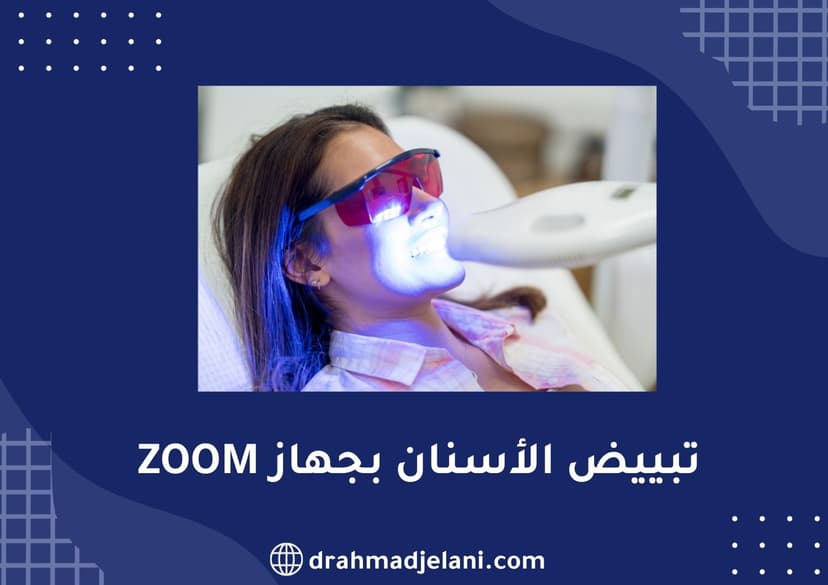 تبييض الأسنان بجهاز ZOOM 4